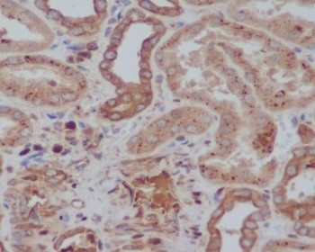 Anti-TH / Tyrosine Hydroxylase, clone ECA-20