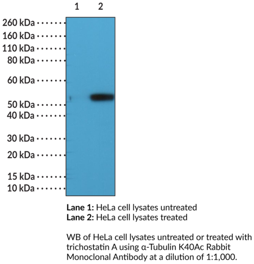 Anti-alpha-Tubulin K40Ac Rabbit Monoclonal Antibody (Clone RM318)