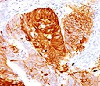 Anti-ALDH1A1, clone AHDH1-1