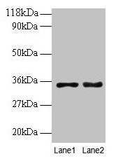 Anti-PTDSS1