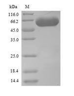Serine--tRNA ligase, Cytoplasmic domain (SES1), Saccharomyces cerevisiae, recombinant