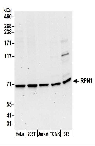 Anti-RPN1/Ribophorin I