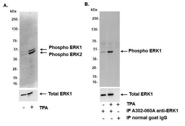Anti-phospho-ERK1/2 (Thr202/Tyr204, Thr185/Tyr187)