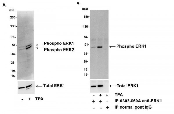 Anti-phospho-ERK1/2 (Thr202/Tyr204, Thr185/Tyr187)