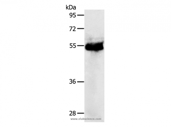 Anti-PRKAR1B