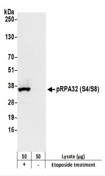 Anti-phospho-RPA32 (Ser4/Ser8) Recombinant Monoclonal