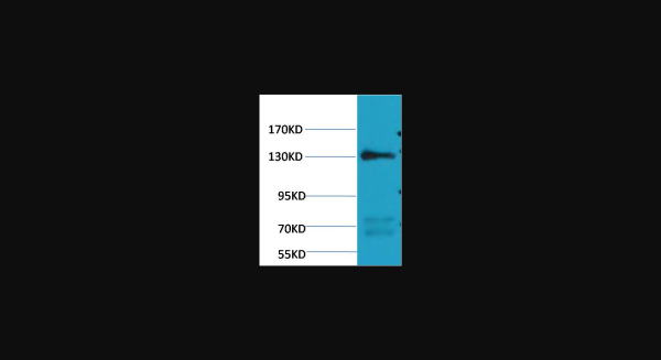 Anti-eNOS, monoclonal