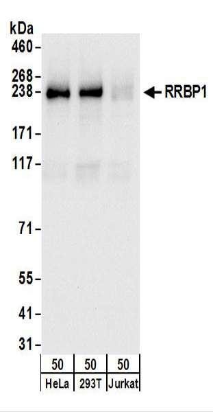 Anti-RRBP1