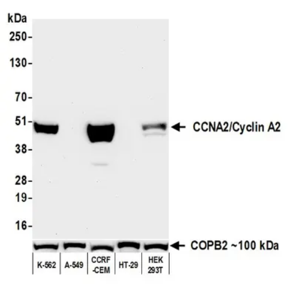 Anti-CCNA2/Cyclin A2 Recombinant Monoclonal