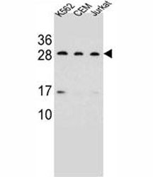 Anti-CD79a Antibody