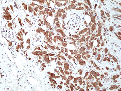 Anti-Musashi 2 (human), Rabbit Monoclonal (RM422)