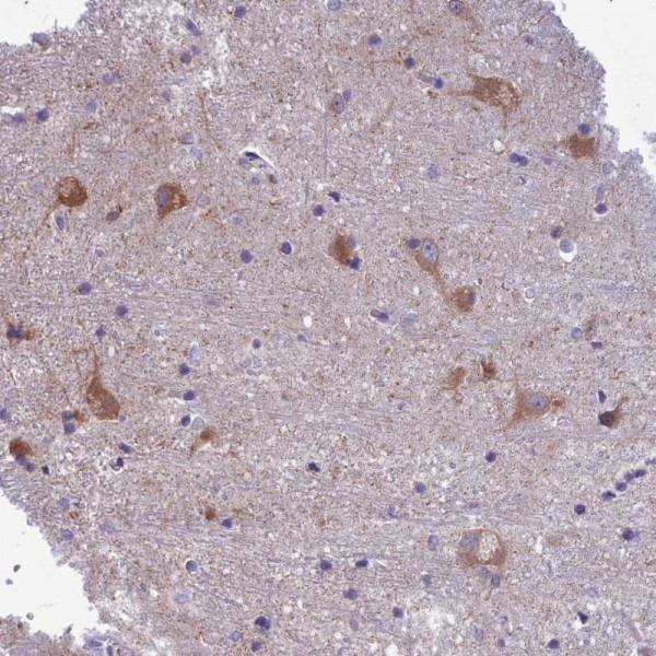 Anti-PCDHB14