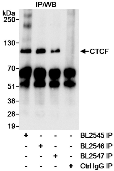 Anti-CTCF