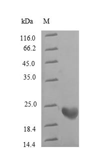Rhodopsin (RHO), partial, human, recombinant