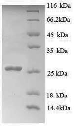 Myelin transcription factor 1 (MYT1), partial, human, recombinant