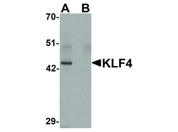 Anti-KLF4, clone [4E5C3]
