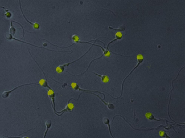 Anti-Intra Acrosomal Protein, clone Hs-14