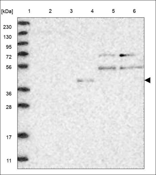 Anti-NEUROD6
