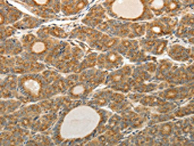 Anti-AKR1C1