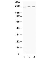 Anti-LIF Receptor / LIFR