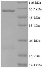 Kynurenine--oxoglutarate transaminase 1 (KYAT1), human, recombinant