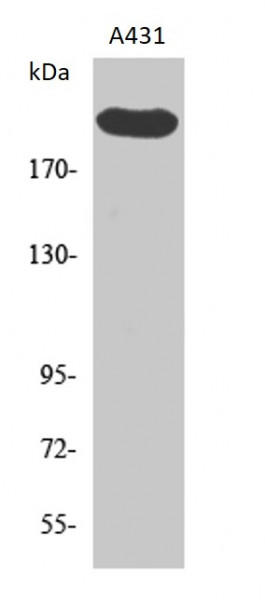 Anti-Separase