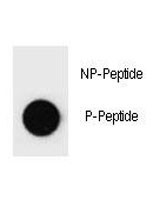 Anti-phospho-PARP1 (Ser373)