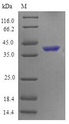 Tumor necrosis factor receptor superfamily member 4 (Tnfrsf4), partial, mouse, recombinant