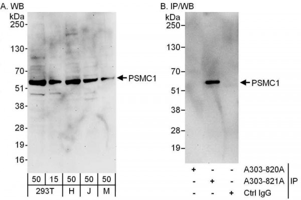 Anti-PSMC1