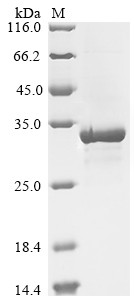 Outer capsid protein VP4, partial, Rotavirus X, recombinant