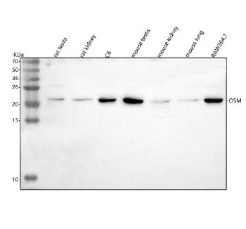 Anti-Osm / Oncostatin M