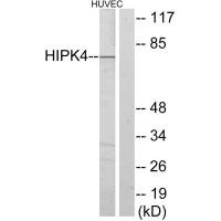 Anti-HIPK4