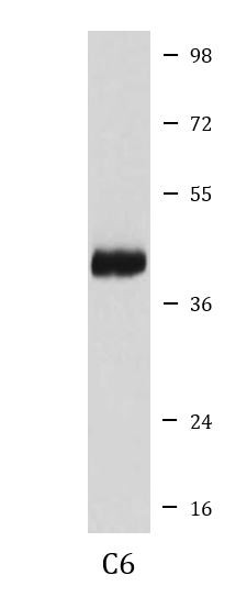 Anti-Doublecortin