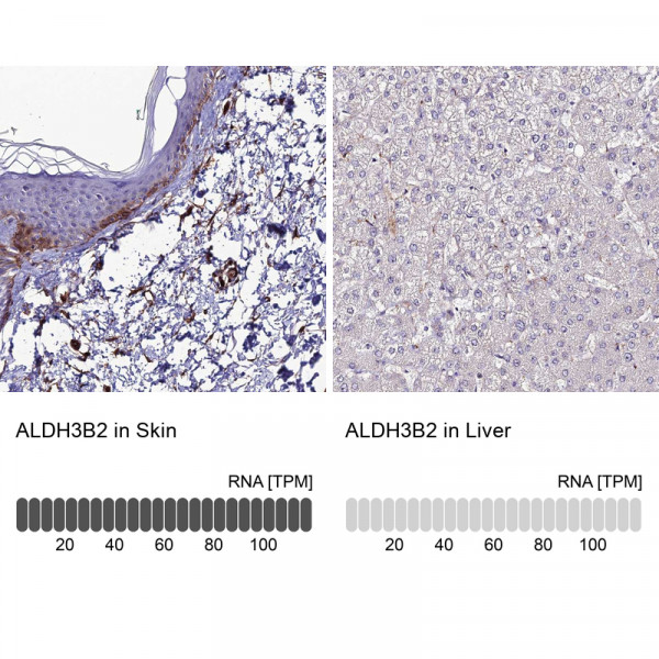 Anti-ALDH3B2