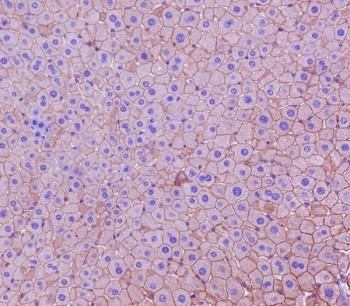 Anti-Cytokeratin 18 / KRT18, clone GBF-11