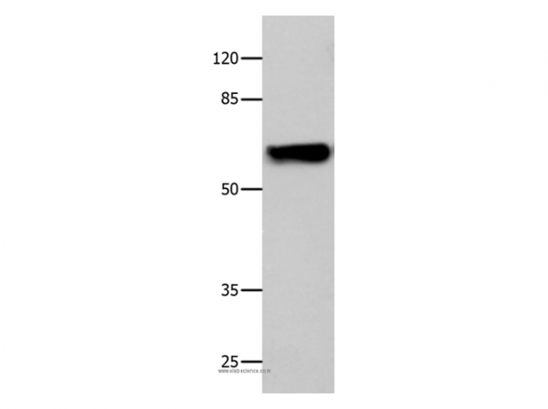 Anti-CNGA2
