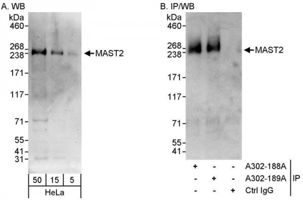 Anti-MAST2