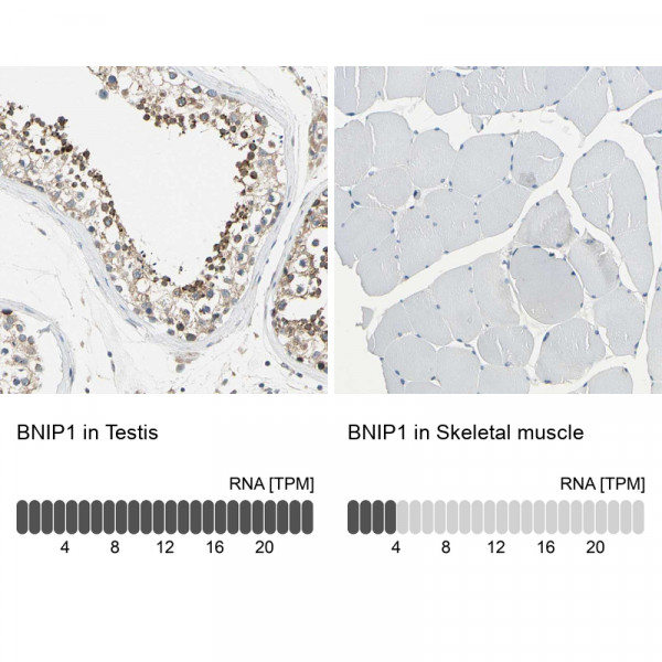 Anti-BNIP1