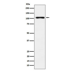 Anti-Thyroid Peroxidase, clone AFFI-20