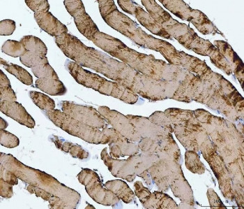 Anti-TNNI1 / Troponin I slow skeletal muscle