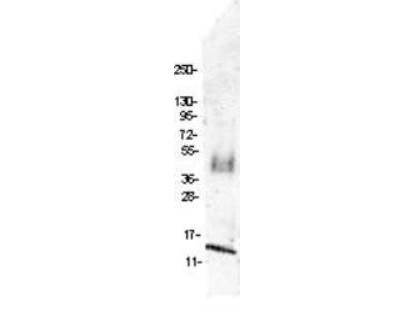 Anti-MIP-1beta