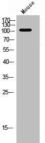 Anti-Phospho-PTK2B (Y881)