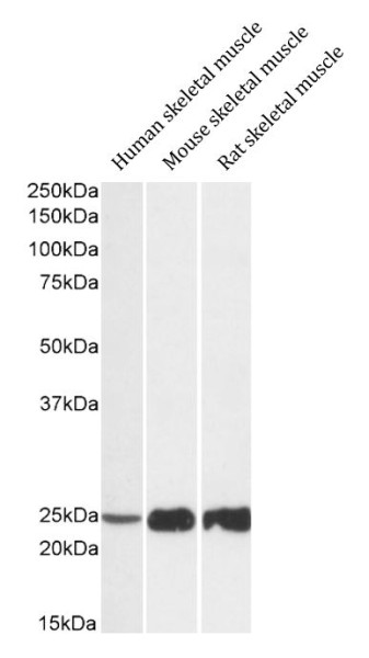Anti-TNNI2