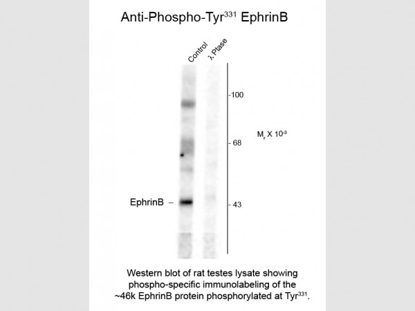 Anti-phospho-EphrinB (Thr331)
