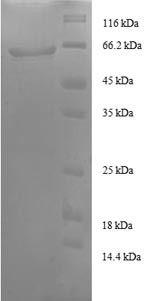 Transaldolase (TALDO1), partial, human, recombinant