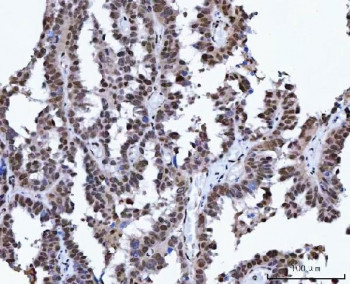 Anti-X-ray repair cross-complementing 4 / XRCC4