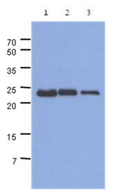 Anti-TNNI1, clone 36E7