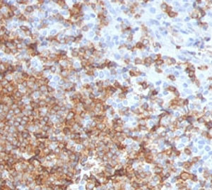 Anti-CD105 / Endoglin, clone CDLA105-1