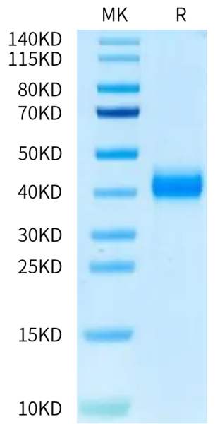 Cynomolgus CD161 Protein