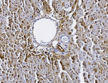 Anti-Alanine aminotransferase 1